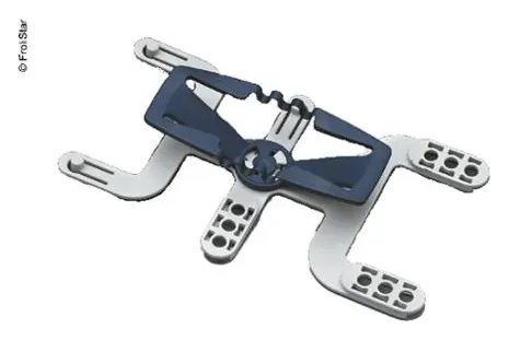 Paquete de extensión de froli-travel
